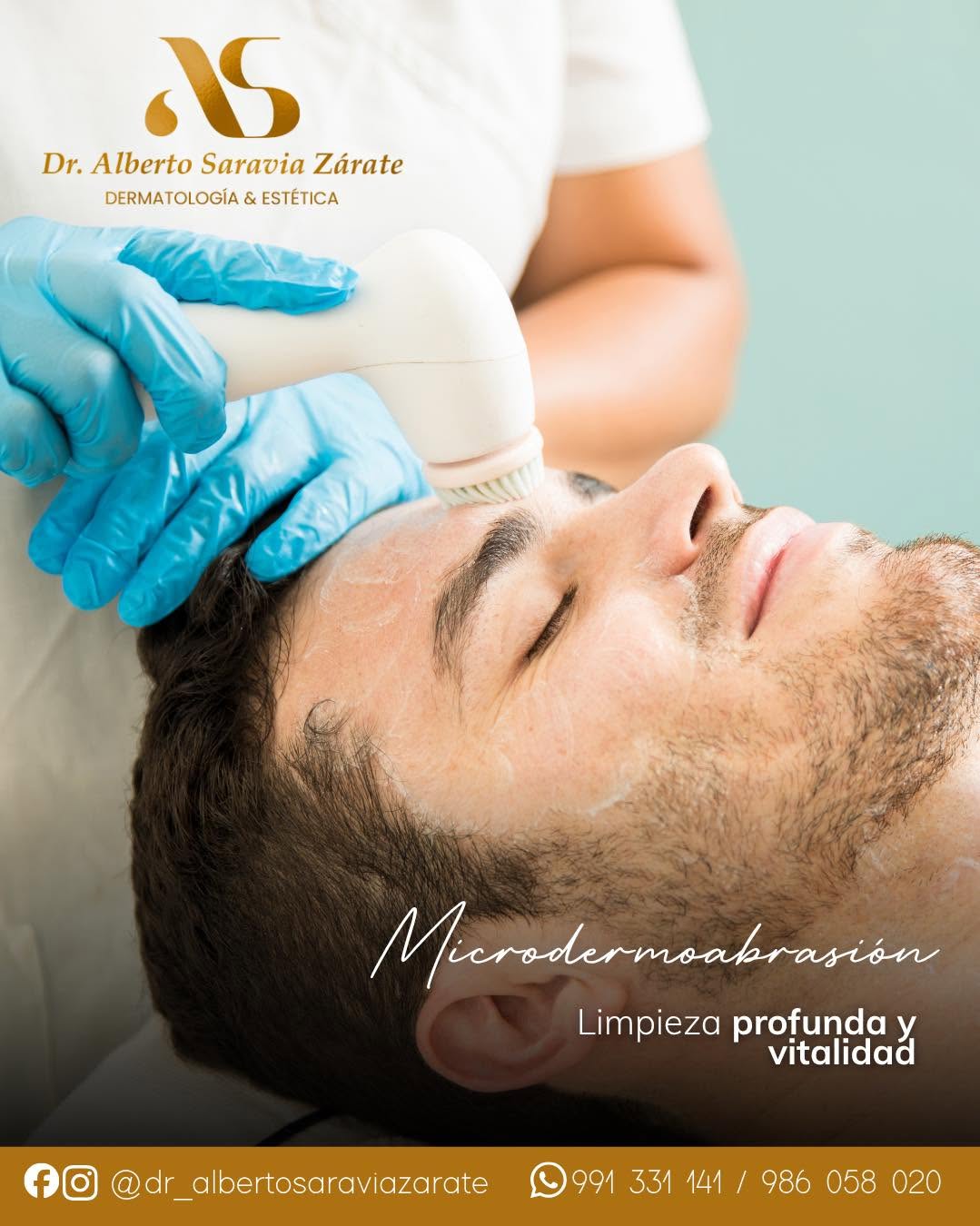 Tratamiento de microdermoabrasión en la clínica